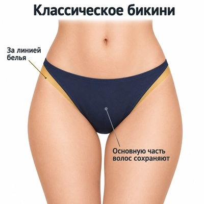 Классическое бикини: зона удаления волос за линией белья