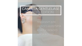 Лазерная эпиляция подмышечных впадин
