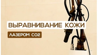 Лазерное выравнивание на аппарате СО2 