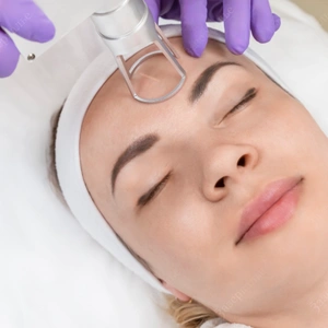 Лазерная шлифовка на аппарате СО2 