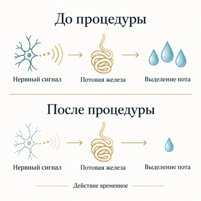 Временное ослабление нервного сигнала уменьшает выделение пота