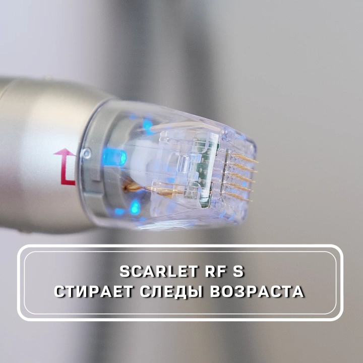 МИКРОИГОЛЬЧАТЫЙ RF ЛИФТИНГ НА АППАРАТЕ SCARLET RF S