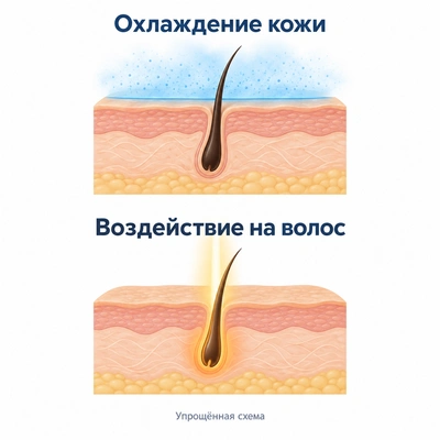 Упрощённая схема охлаждения кожи и воздействия лазера на волос