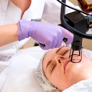 Про лазер СО2