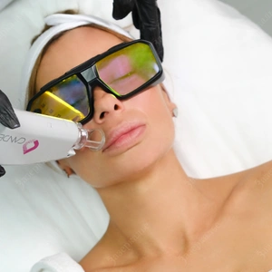 Лазерная эпиляция CANDELA GentleLASE